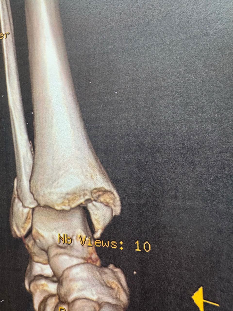 Pre-operative image 6
