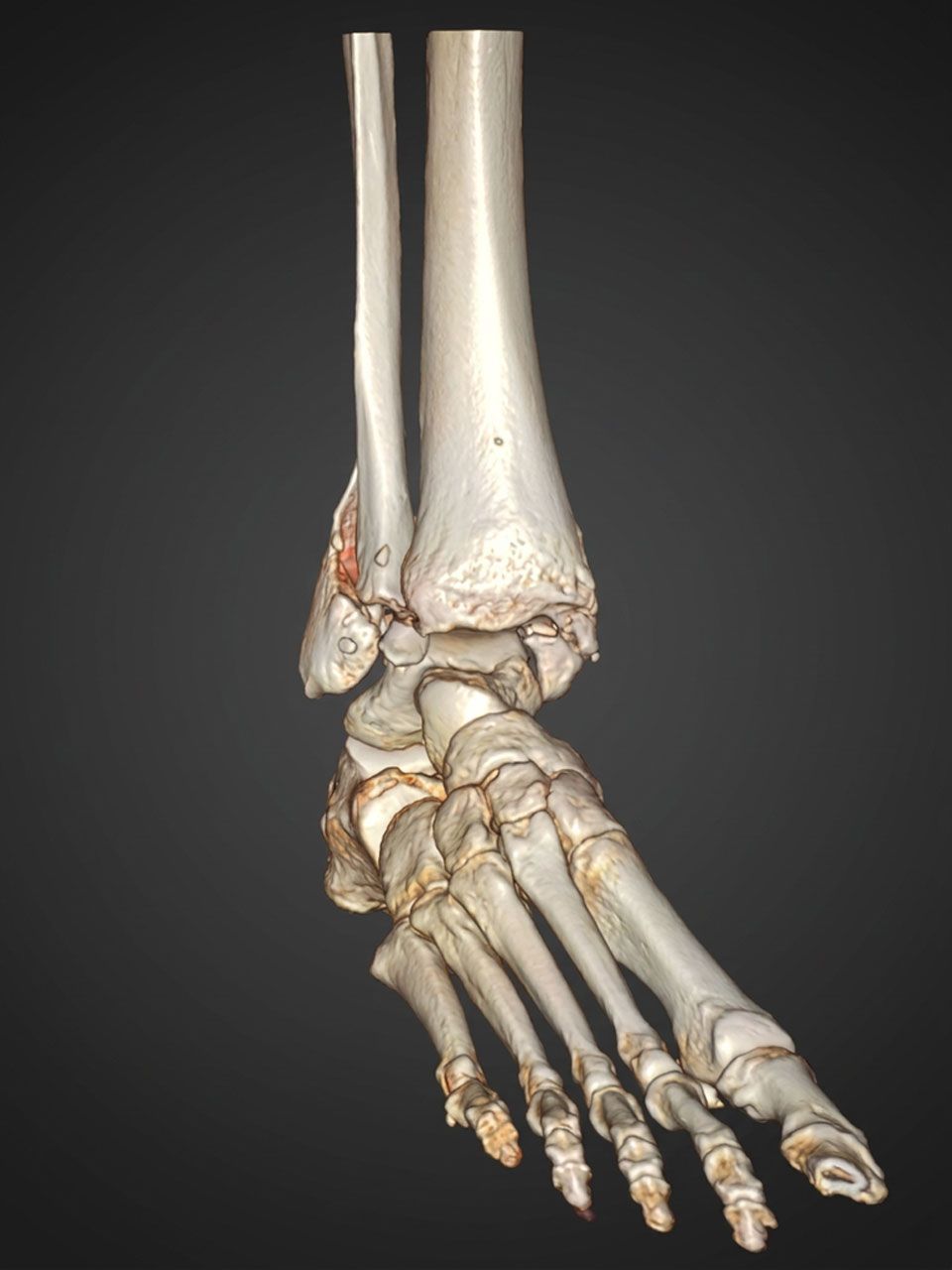 Pre-operative image 2