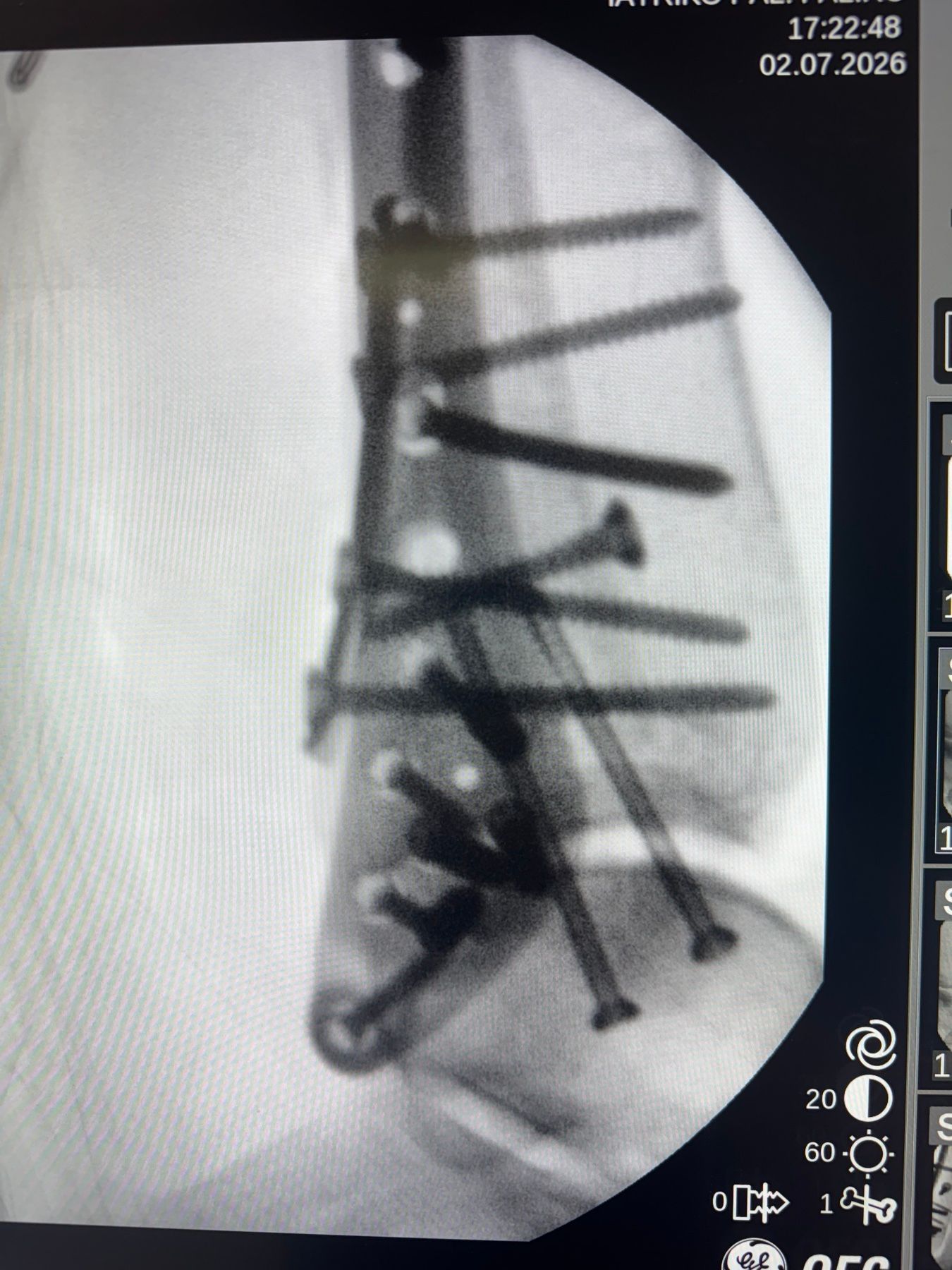 Post-operative image 3