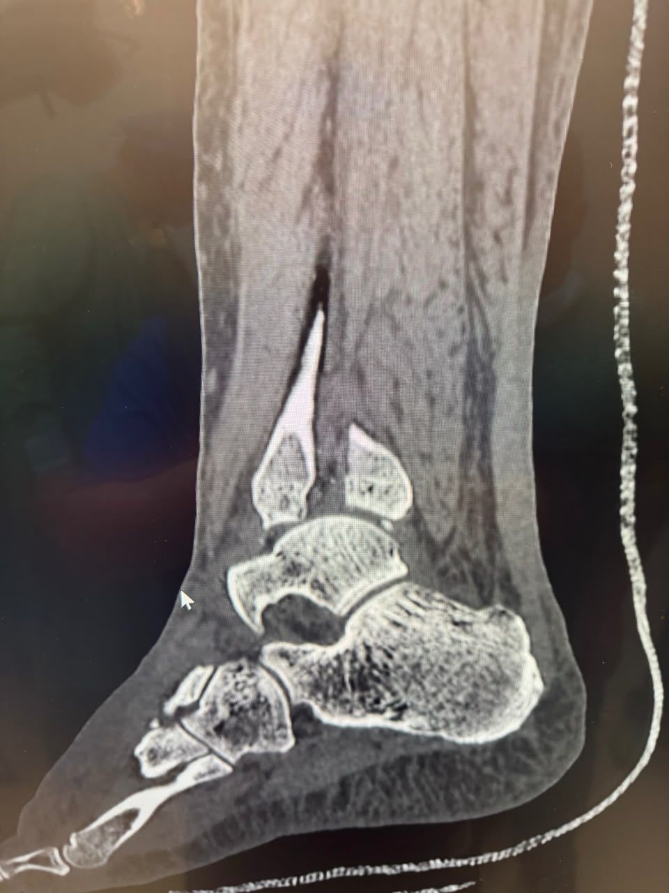 Pre-operative image 22