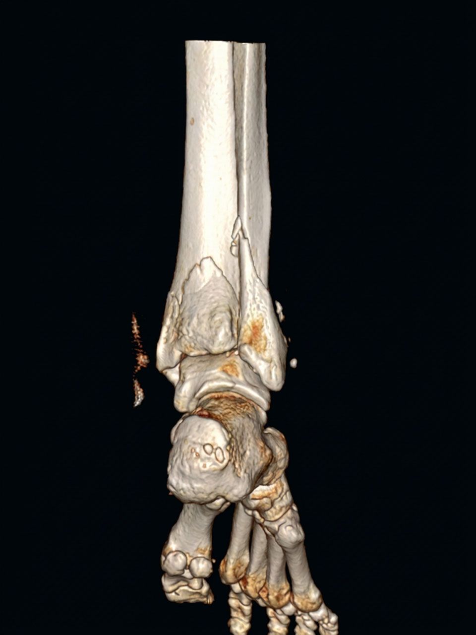 Pre-operative image 3