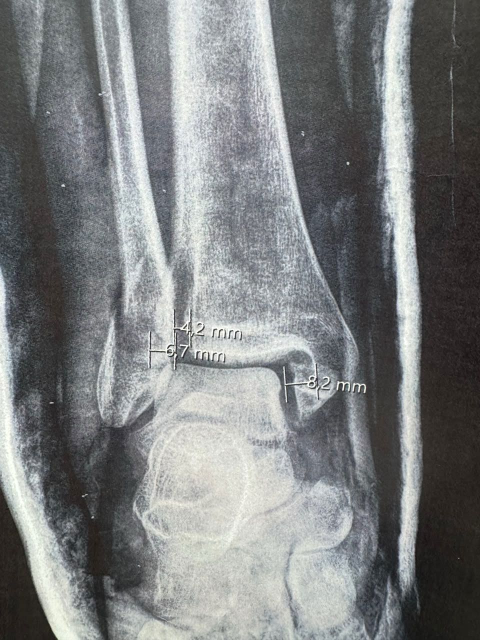 Pre-operative image 5