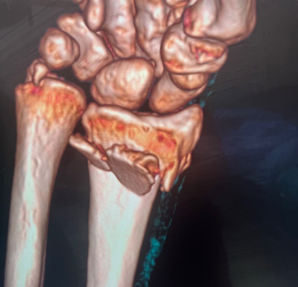 Pre-operative wrist image 2