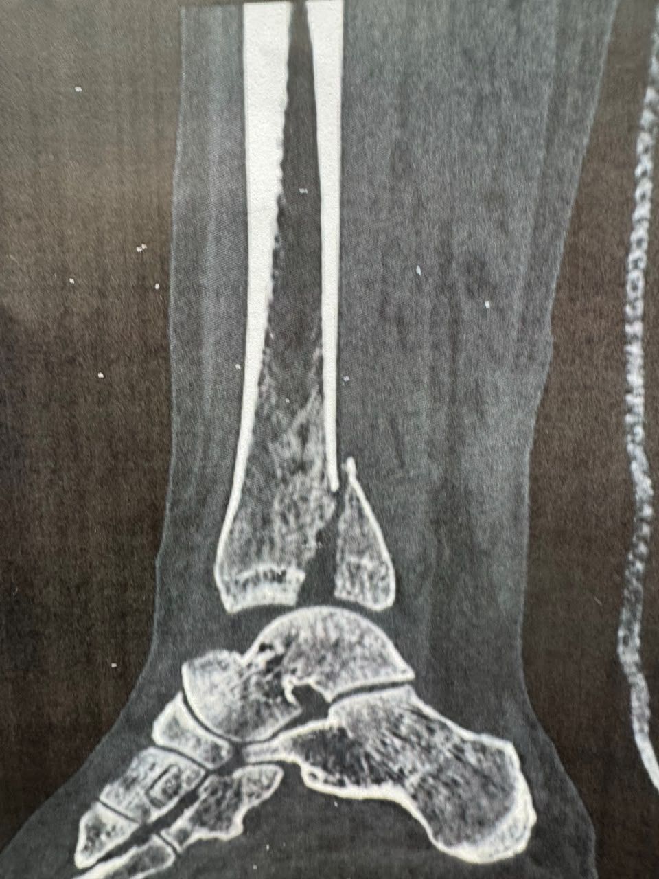 Pre-operative image 6