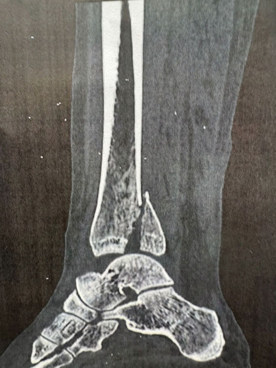 Pre-operative image 4