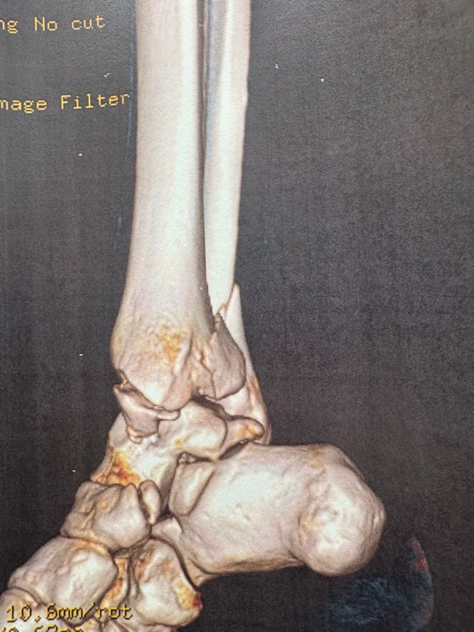 Pre-operative image 3