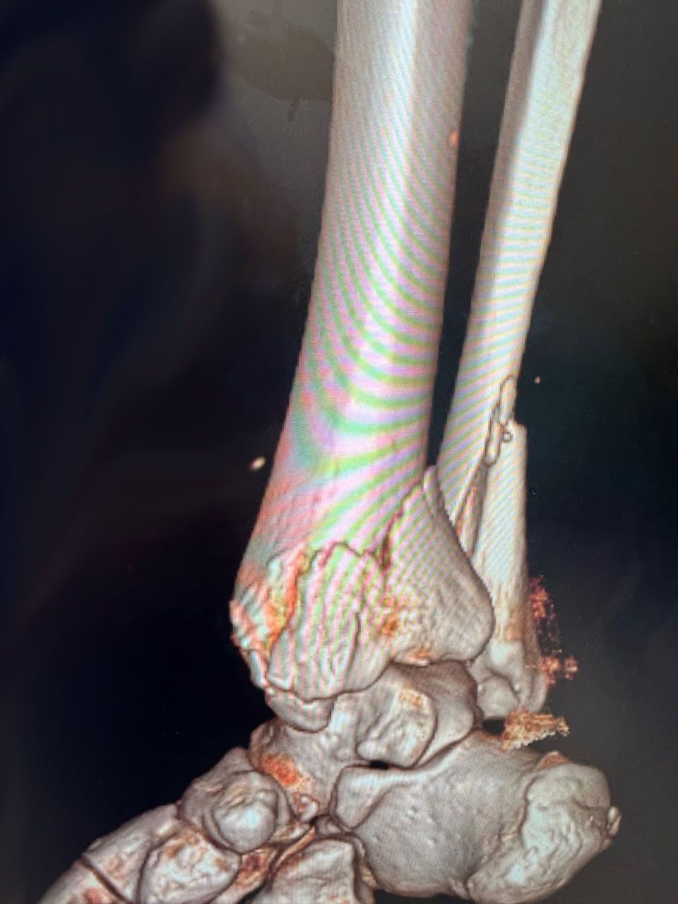 Pre-operative image 5