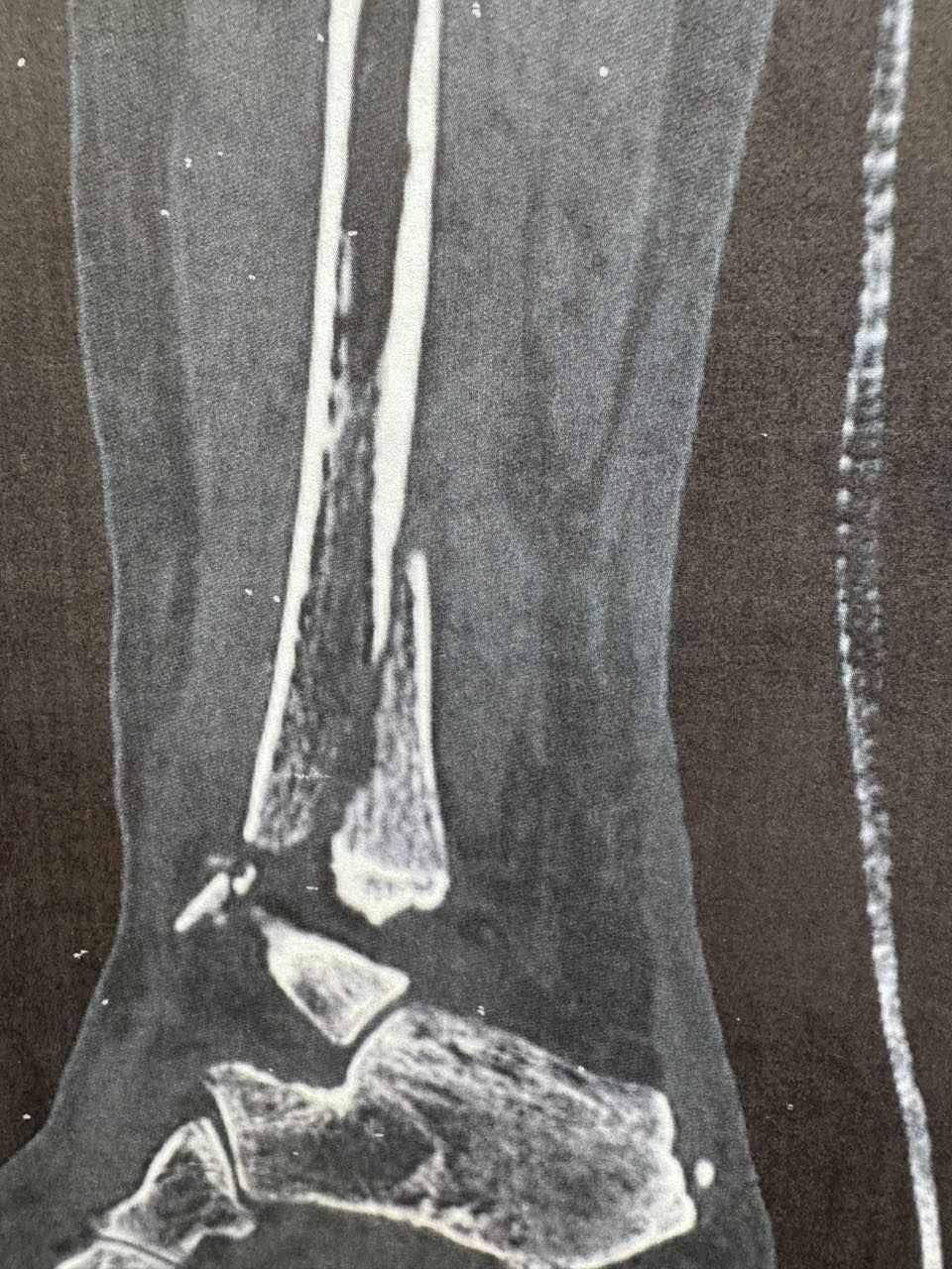 Pre-operative image 10