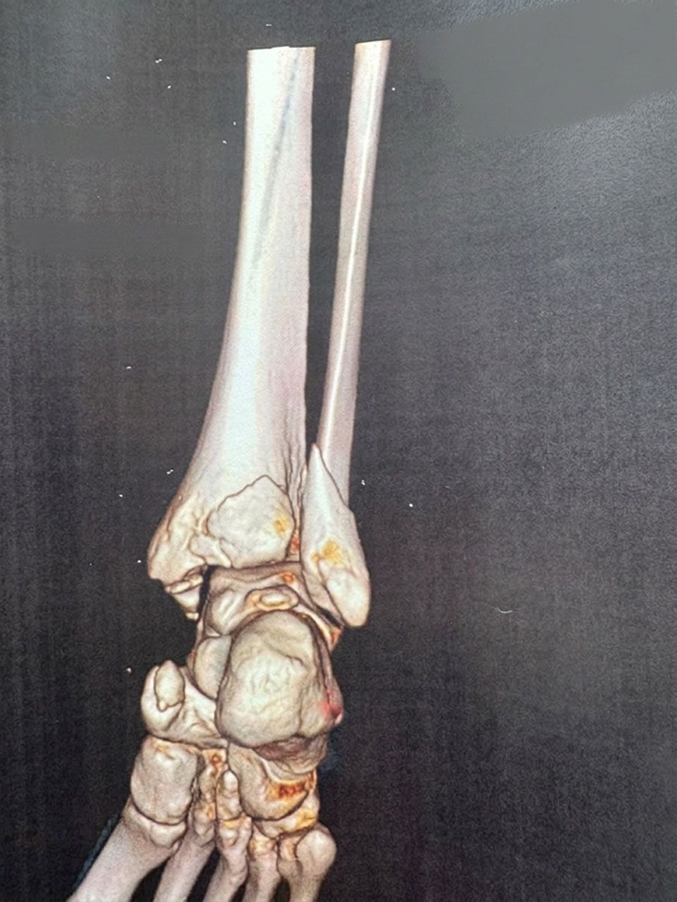 Pre-operative image 4