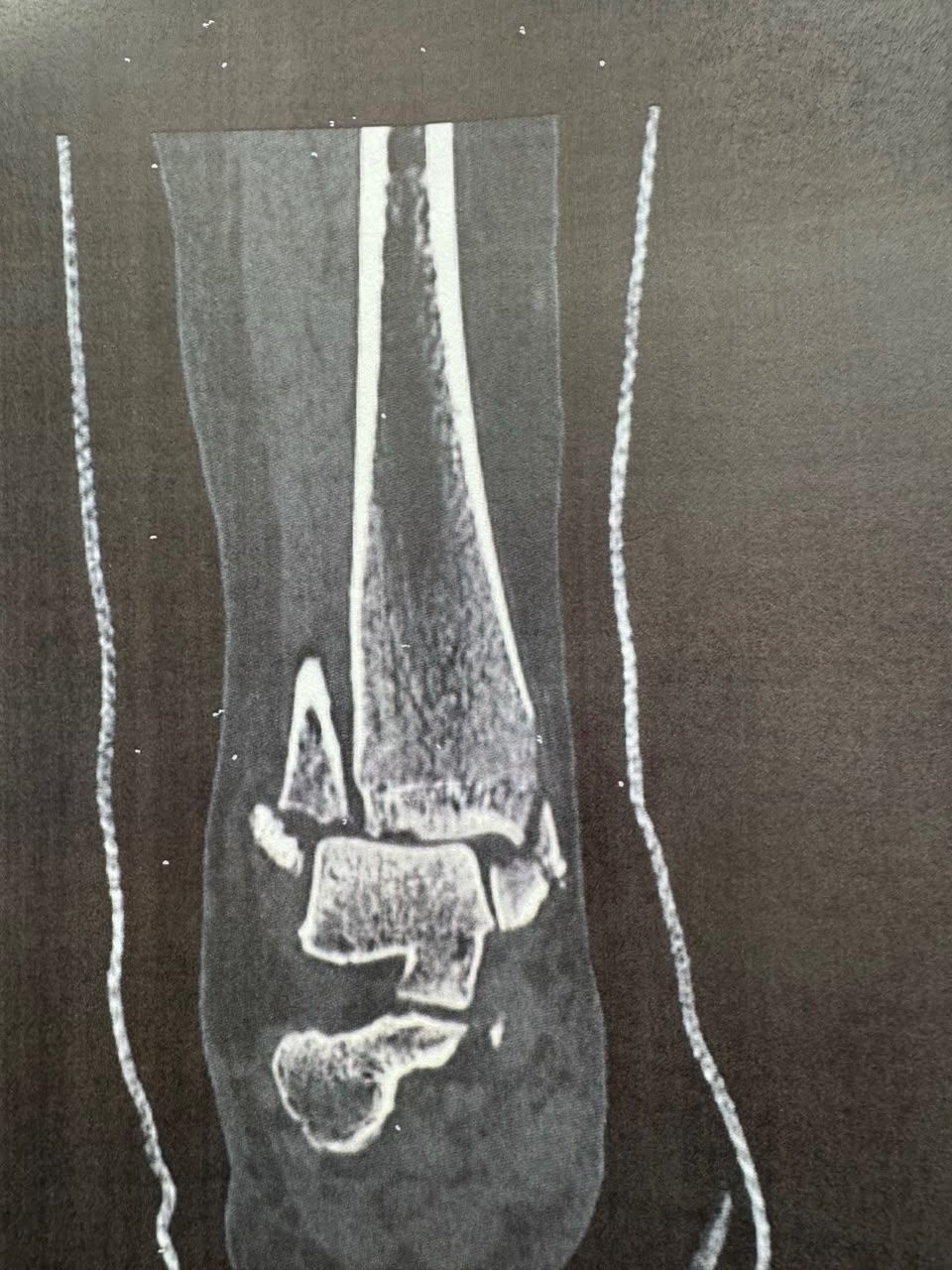 Pre-operative image 8