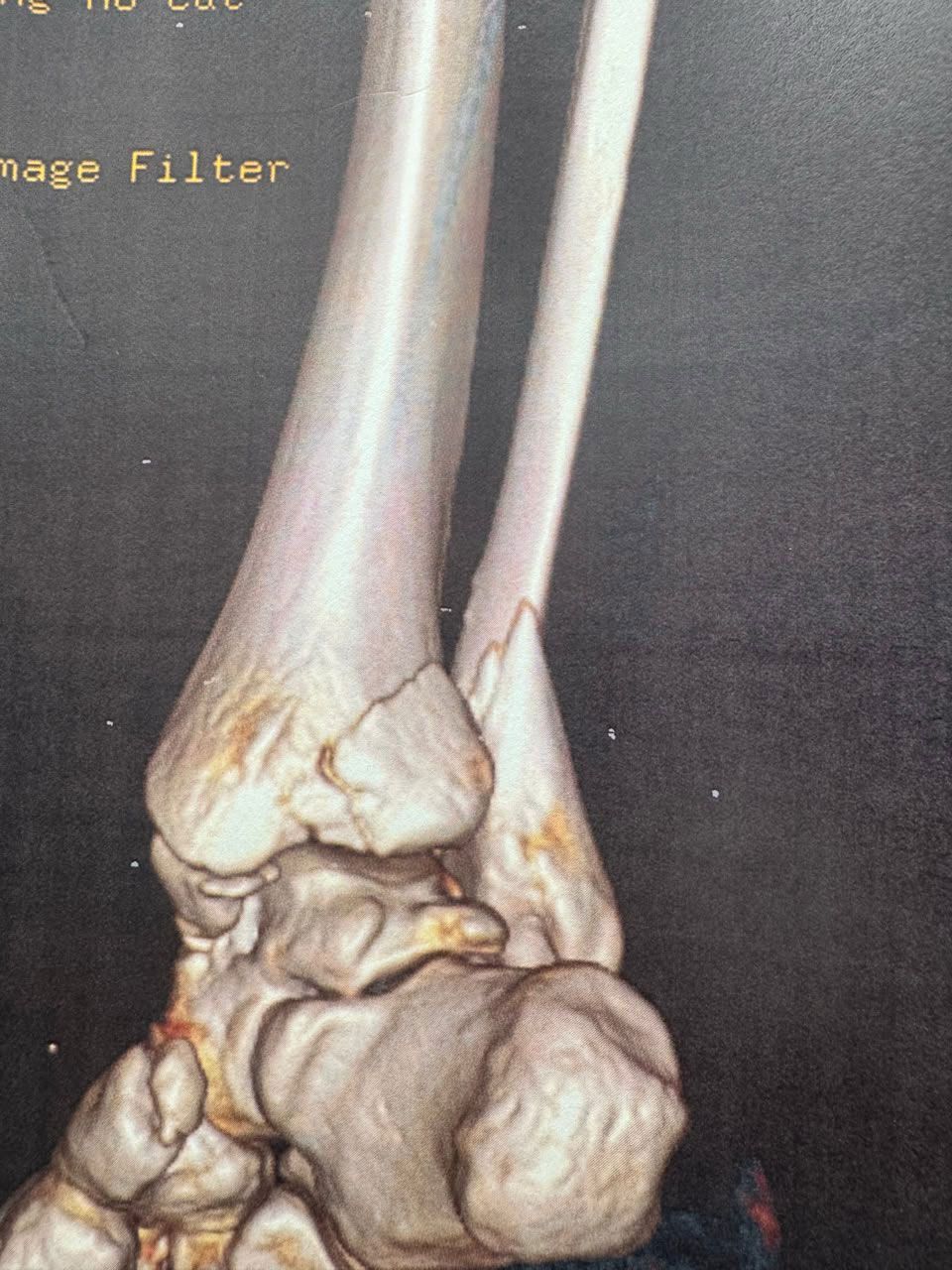 Pre-operative image 2