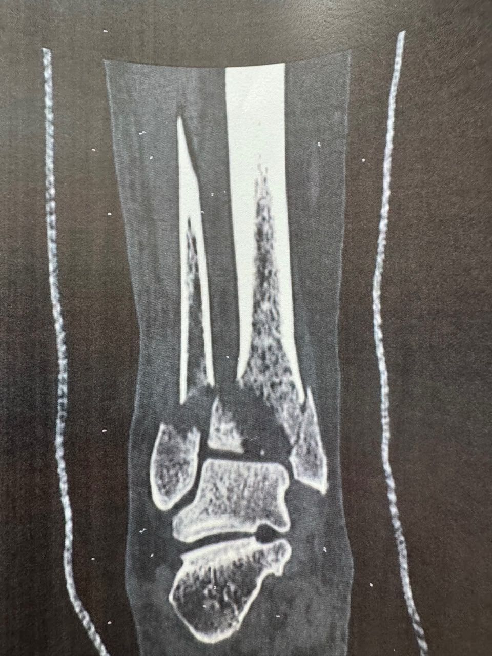 Pre-operative image 9