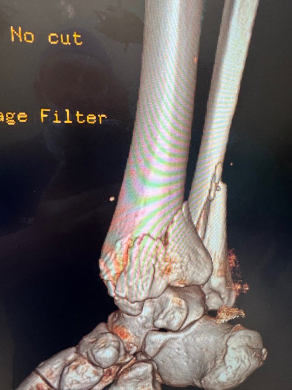 Pre-operative image 7