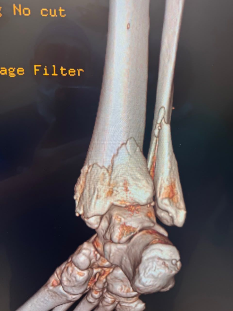 Pre-operative image 11