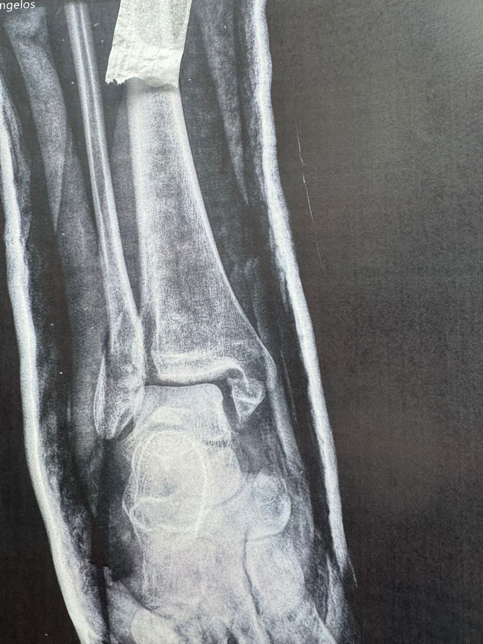 Pre-operative image 1