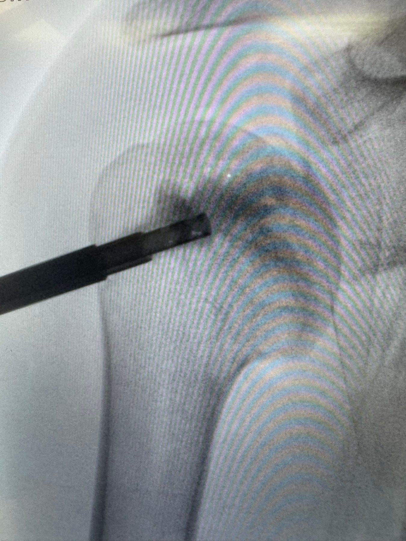 INNOTERE injection — paste application