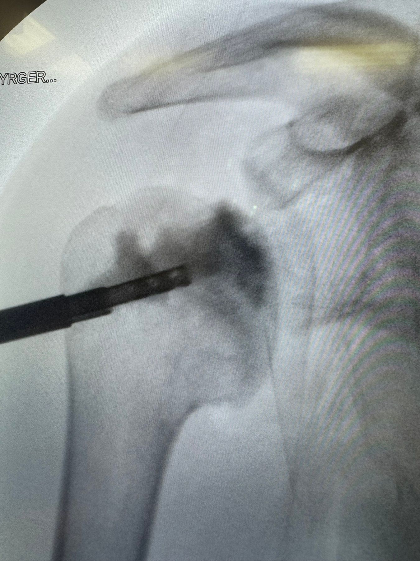 Post-operative imaging — final result view 2