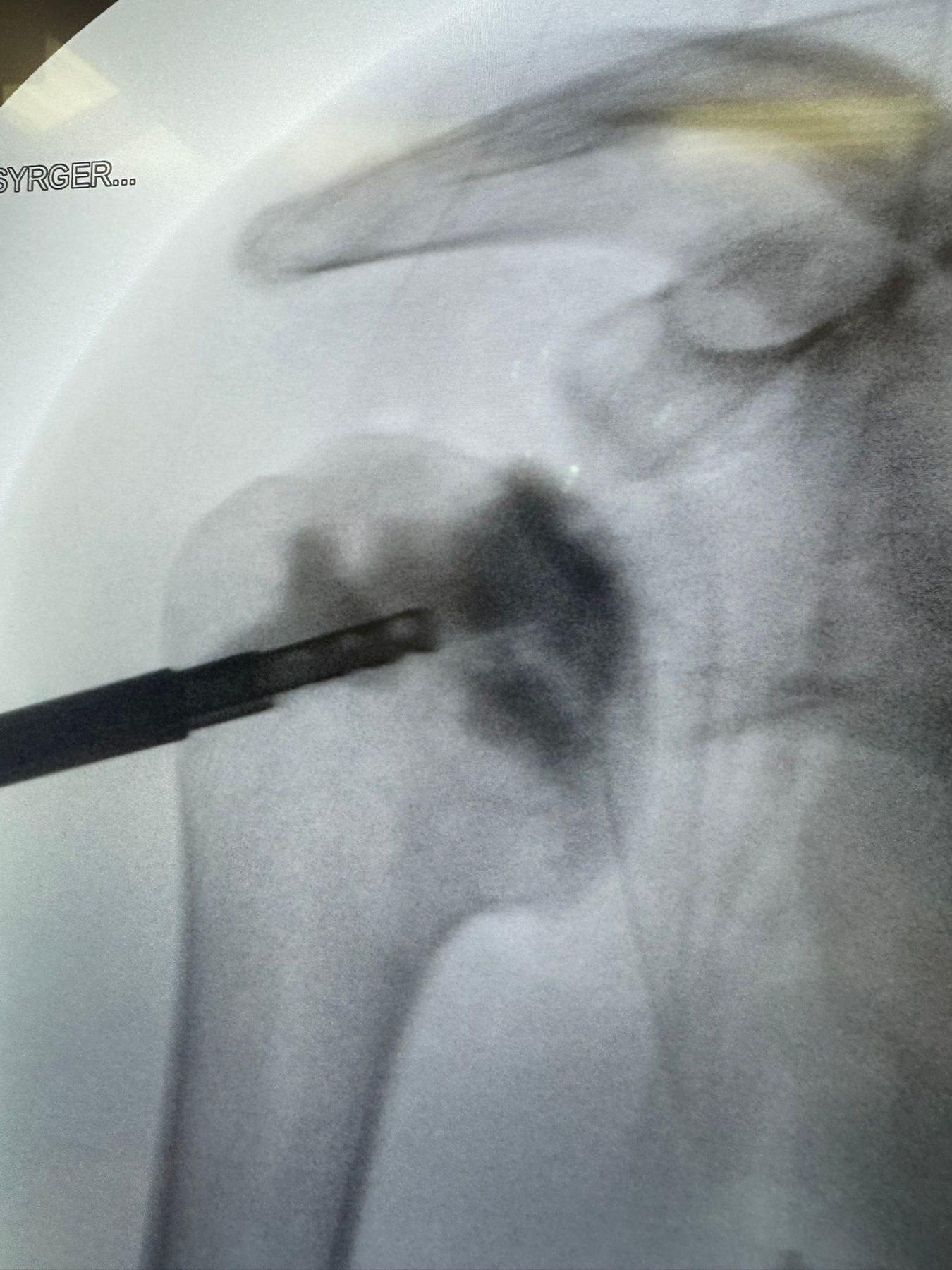 Post-operative imaging — final result view