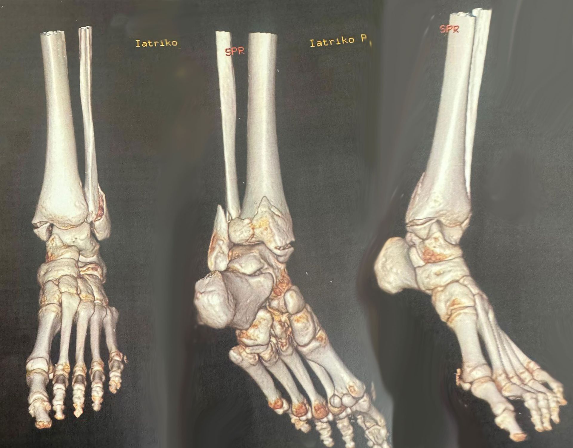 Before surgery image 2