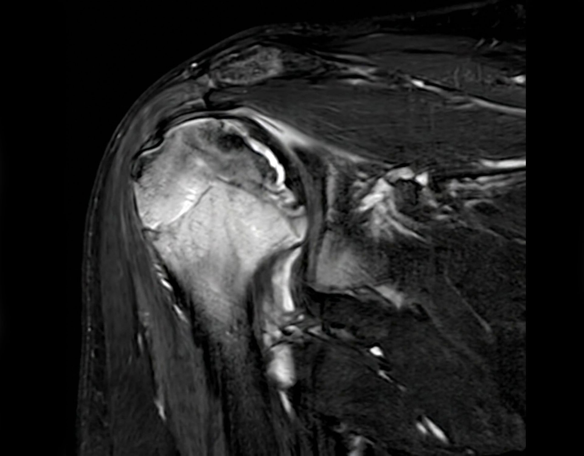 Pre-operative imaging — 3D reconstruction