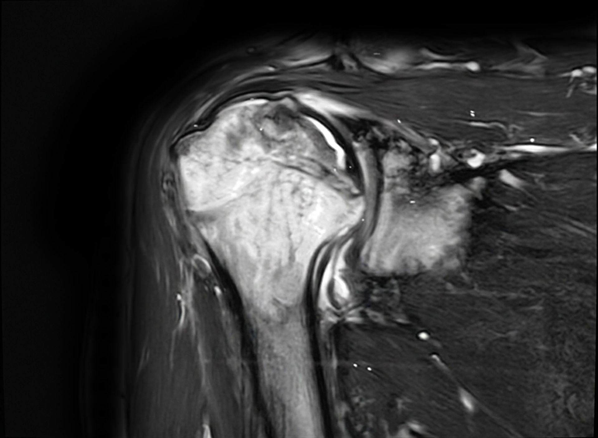 Pre-operative imaging — sagittal view