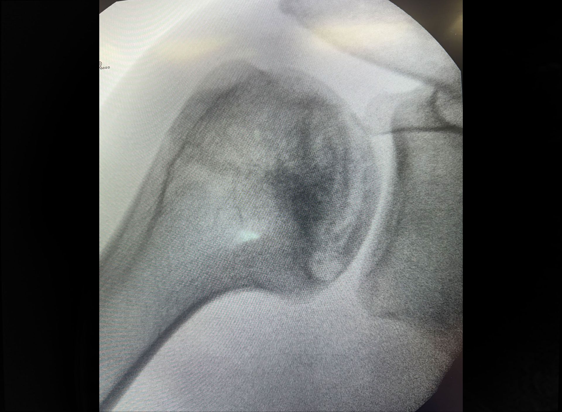 Pre-operative imaging — axial view