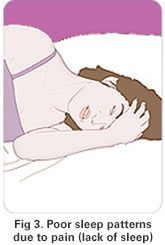 Poor Sleep patterns
