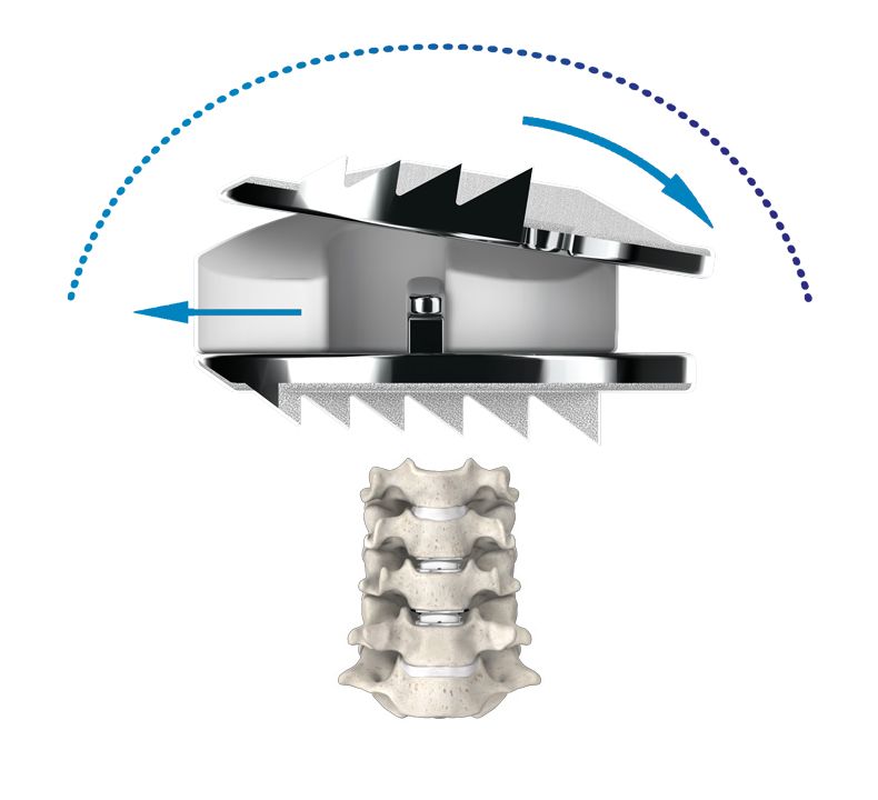Mobi-C Installment