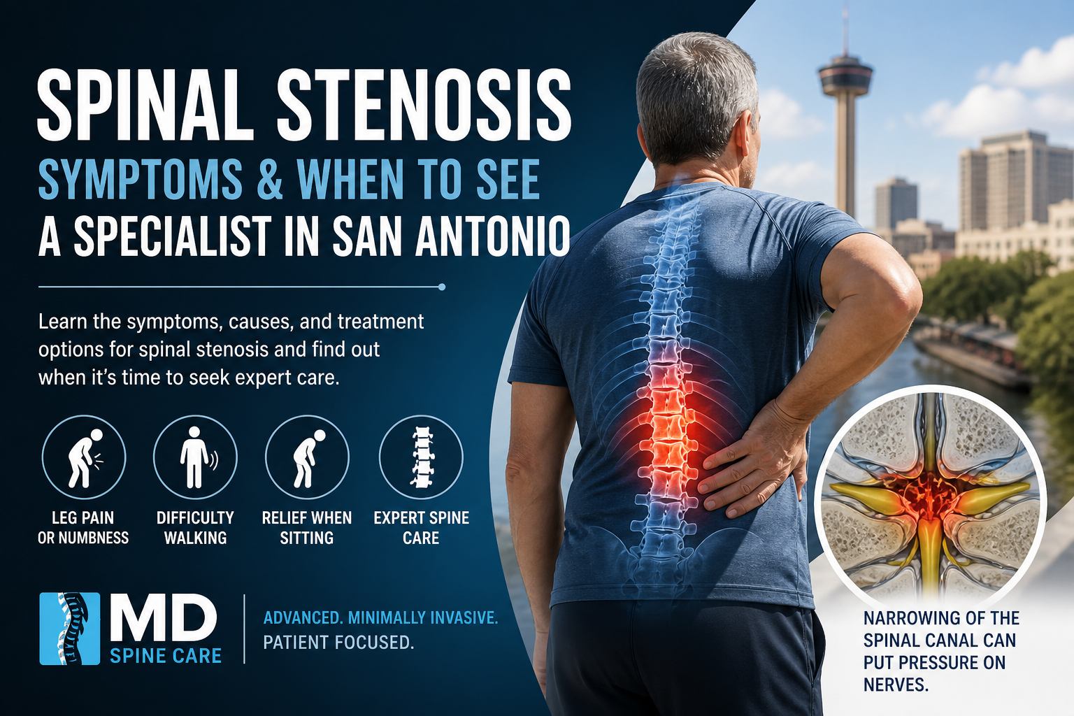 Spinal stenosis awareness poster with back pain graphic, symptom icons, and San Antonio skyline