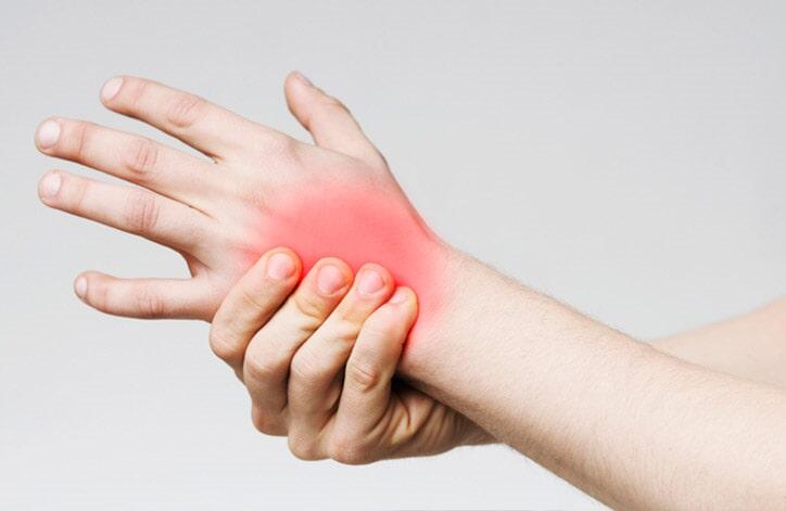 DRA. DESIRÉE SEPÚLVEDA ALDANA - LUPUS ERITEMATOSO