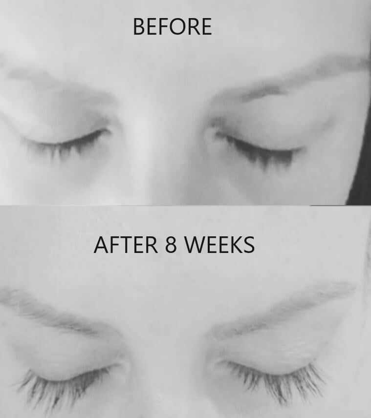 Before and After 8 Weeks Lash Boost