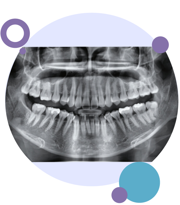 Digital panoramic x-ray