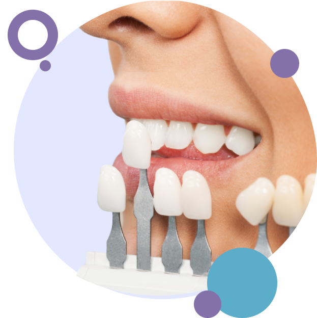 Dentist holding veneer shade guide up to patient's teeth