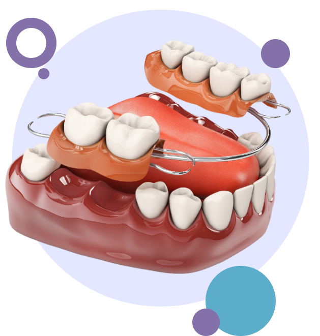 Invisalign