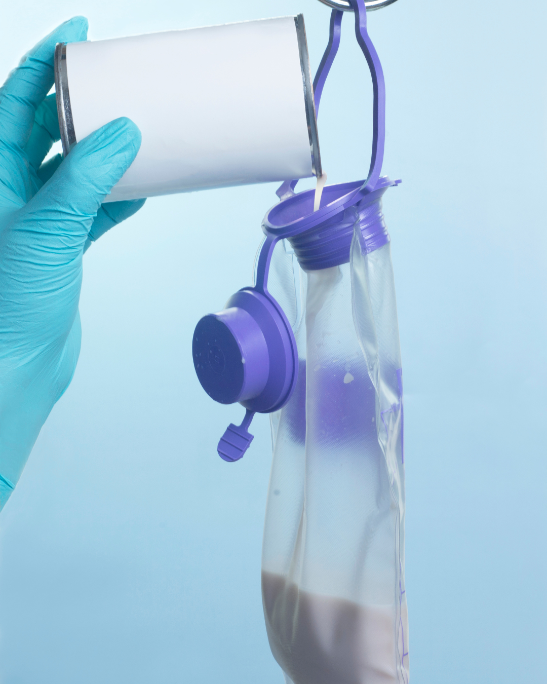 A gloved hand filling a feeding tube for a ventilator dependent resident