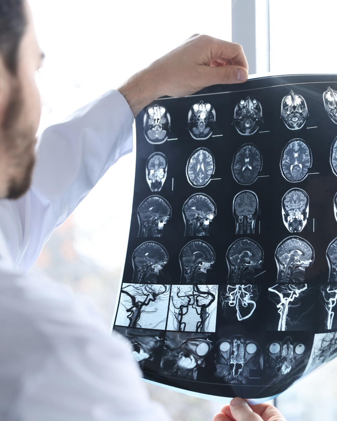A doctor studying the affects of brain injury on a x-ray