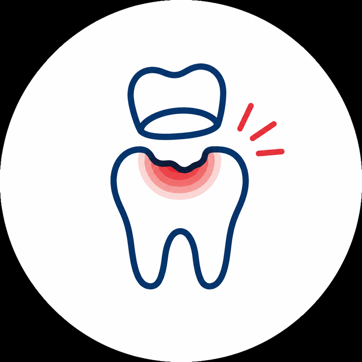 Illustration of a painful tooth and gum, with a dislodged cap above it and red pain marks.