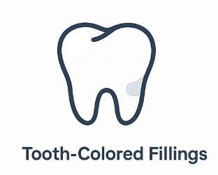 Tooth-colored dental filling illustration