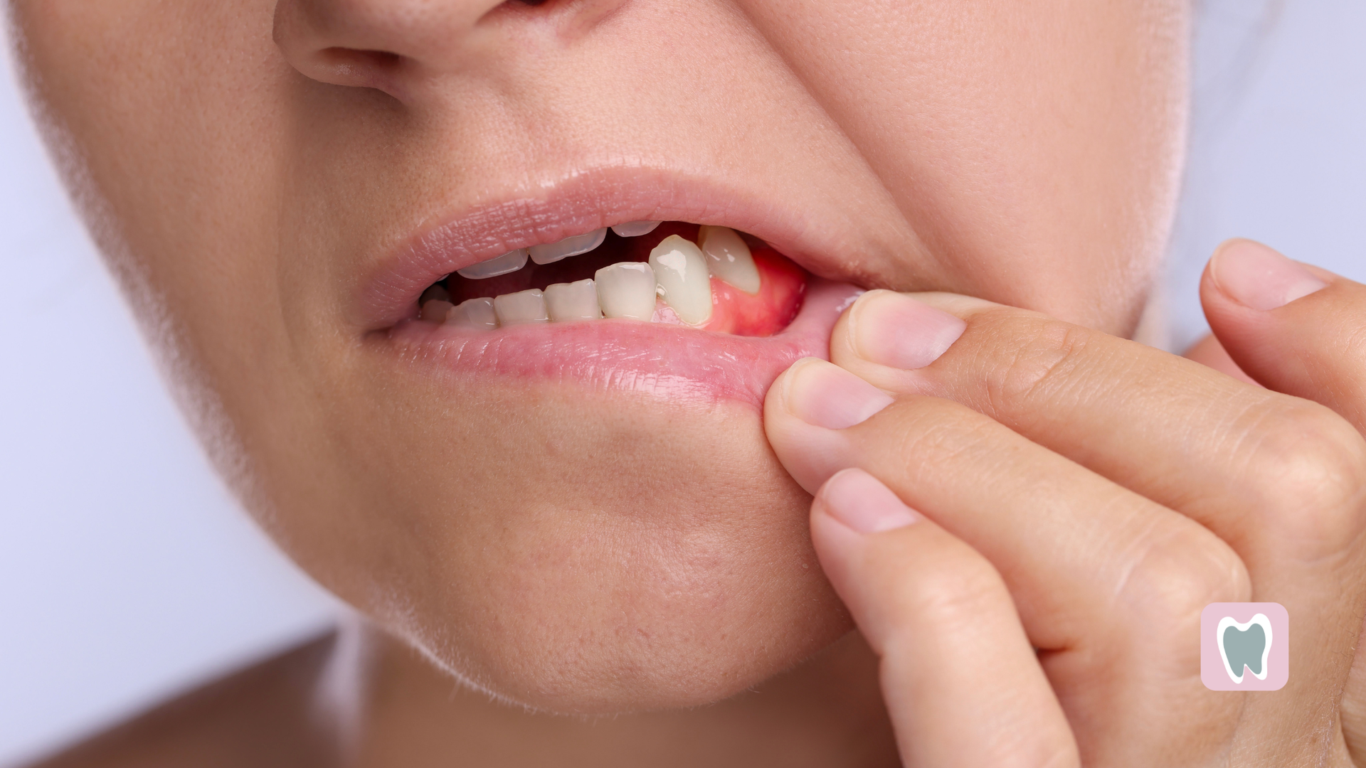 Woman with inflamed gums, touching her mouth in pain.