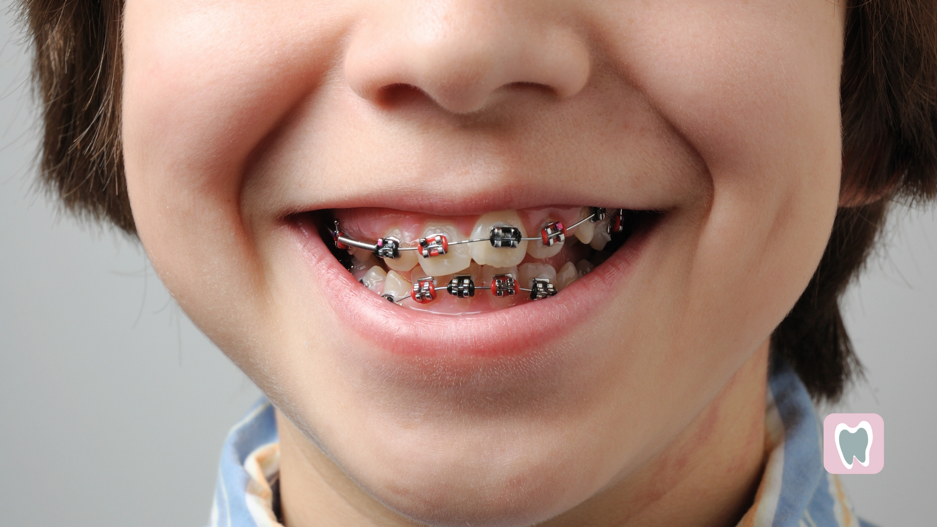 A young boy with braces on his teeth is smiling.