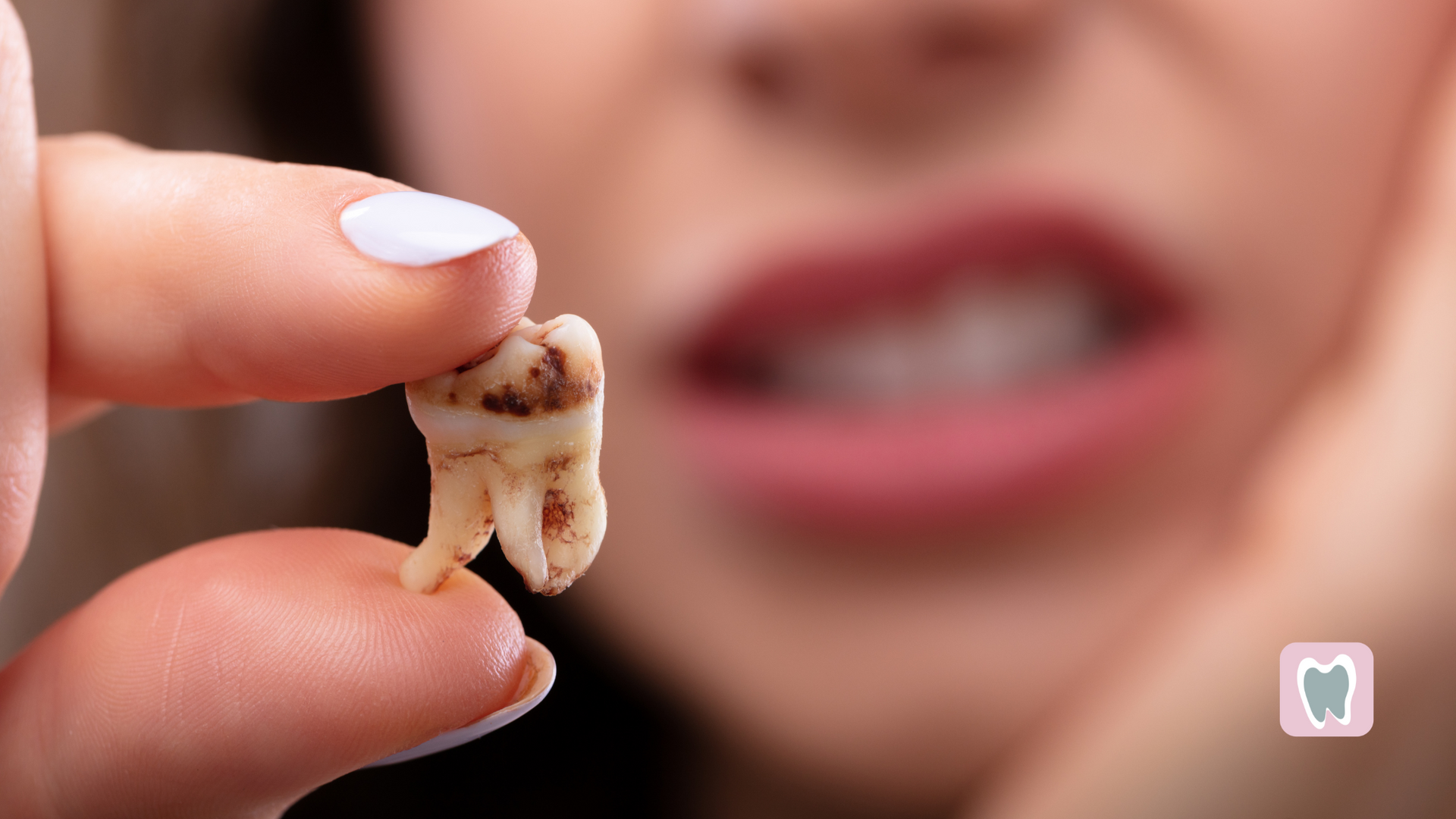 Person holding a decayed tooth with worried expression; out-of-focus mouth in background.