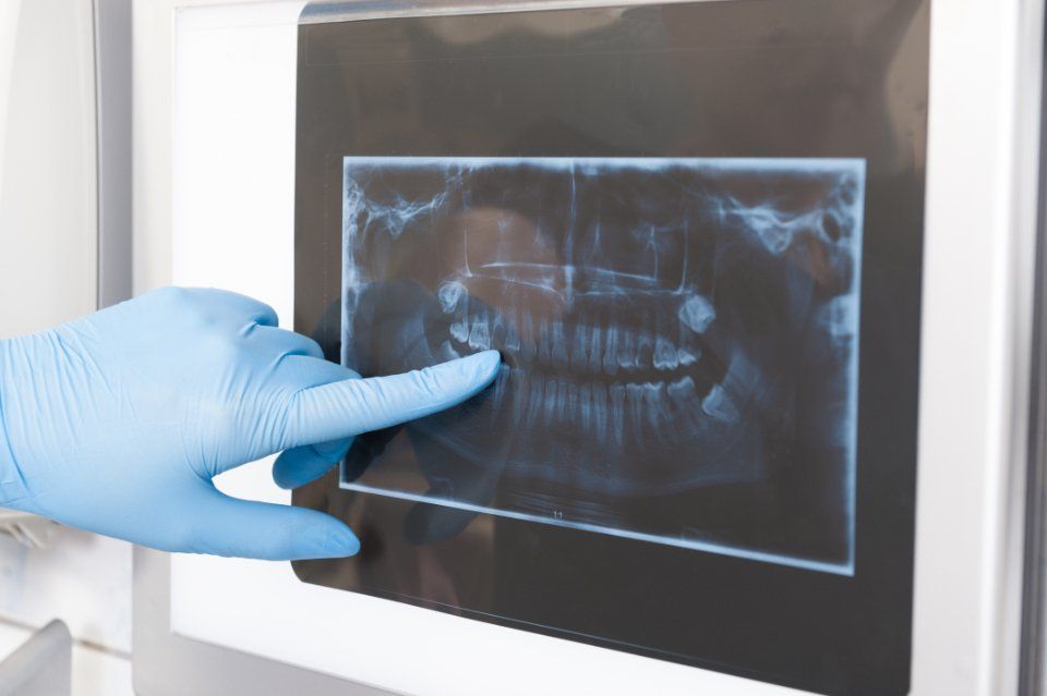 Controllo della panoramica dentale