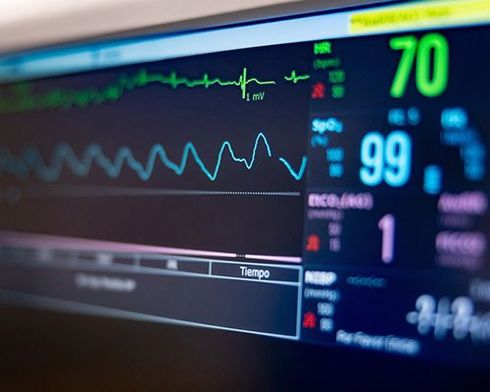 Monitores vitales
