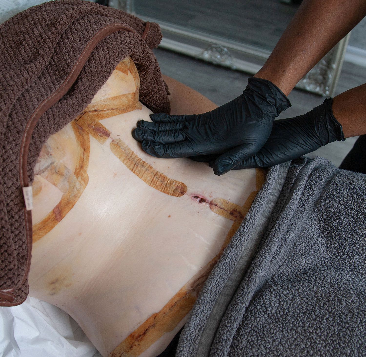 A woman is laying on a bed getting a lymphatic treatment