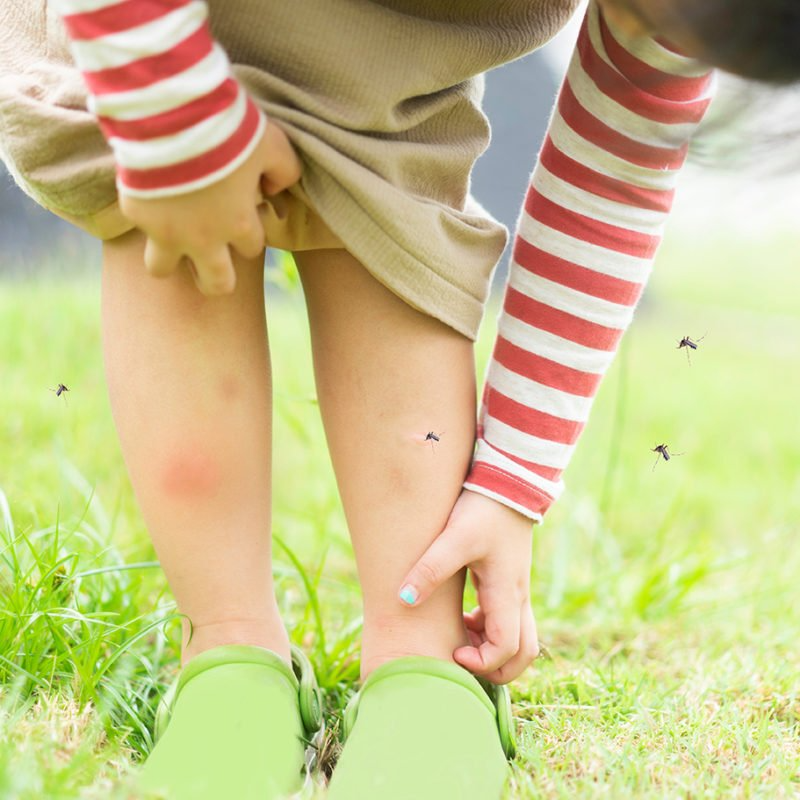 Child scratching leg outdoors; mosquitoes fly around.