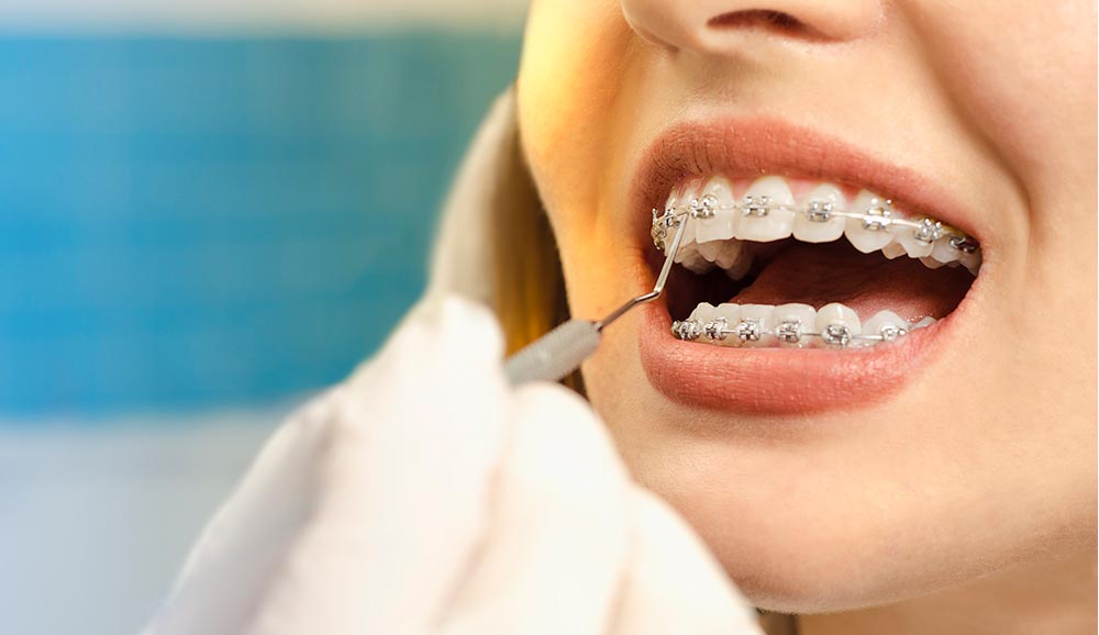 Orthodontics