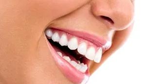 view of teeth whitening before and after