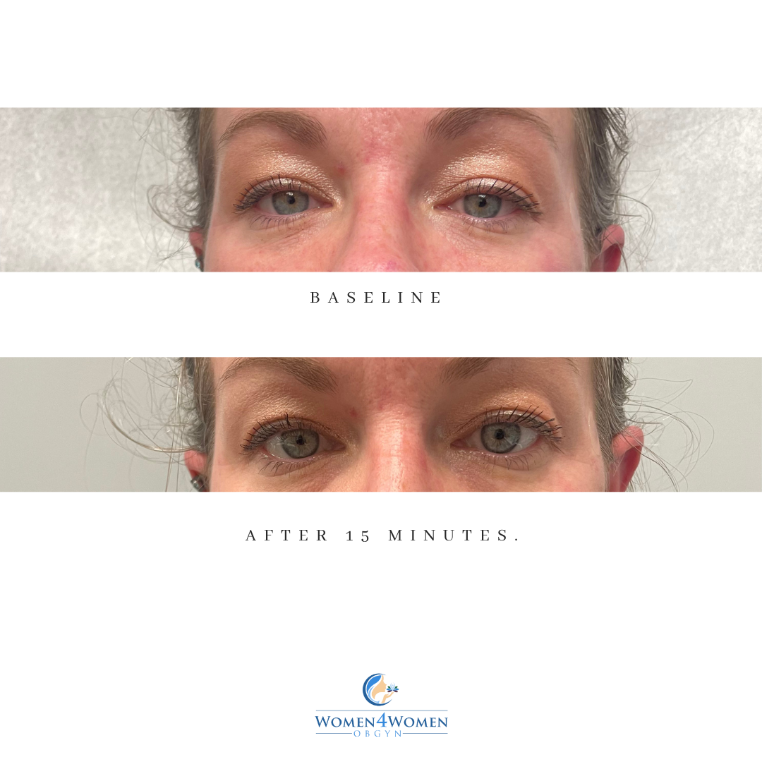 A before and after photo of a woman 's eyes