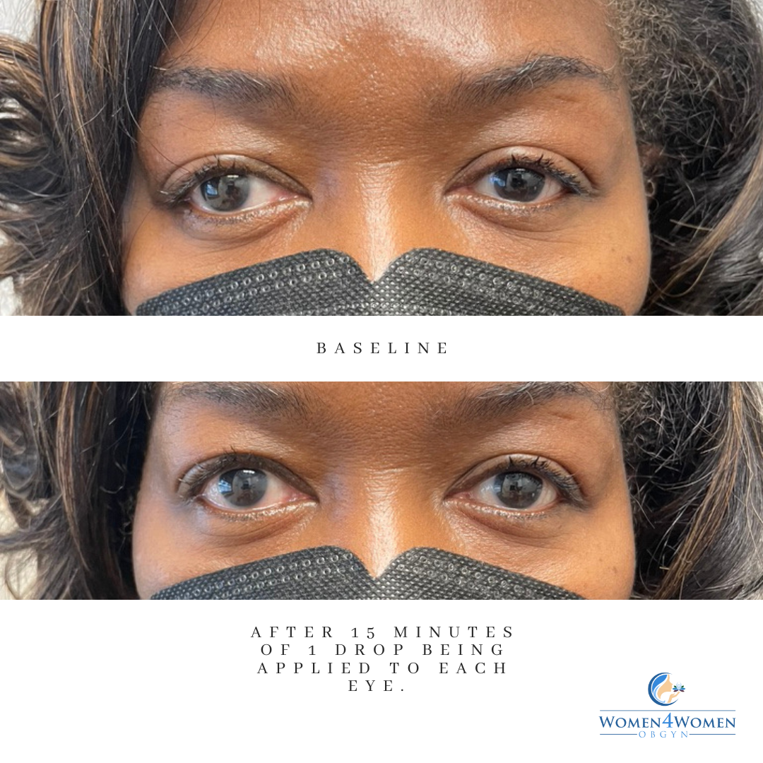A before and after photo of a woman wearing a mask