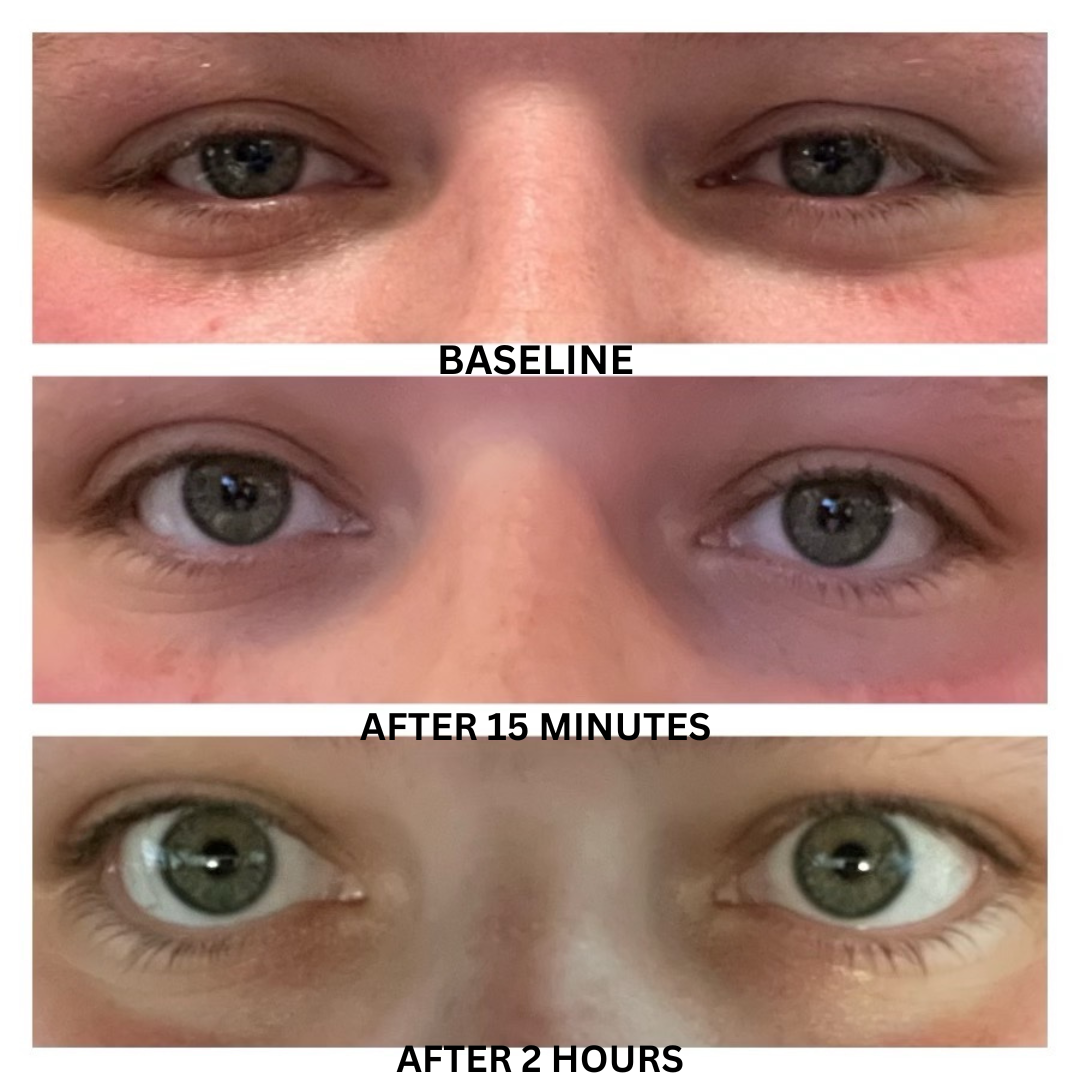 A before and after picture of a woman 's eyes